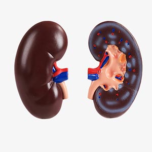 Kidney model