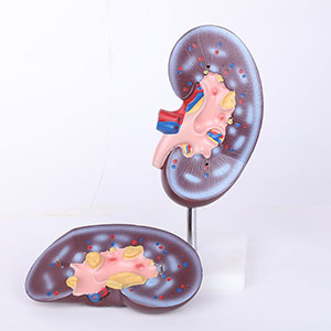 Kidney model